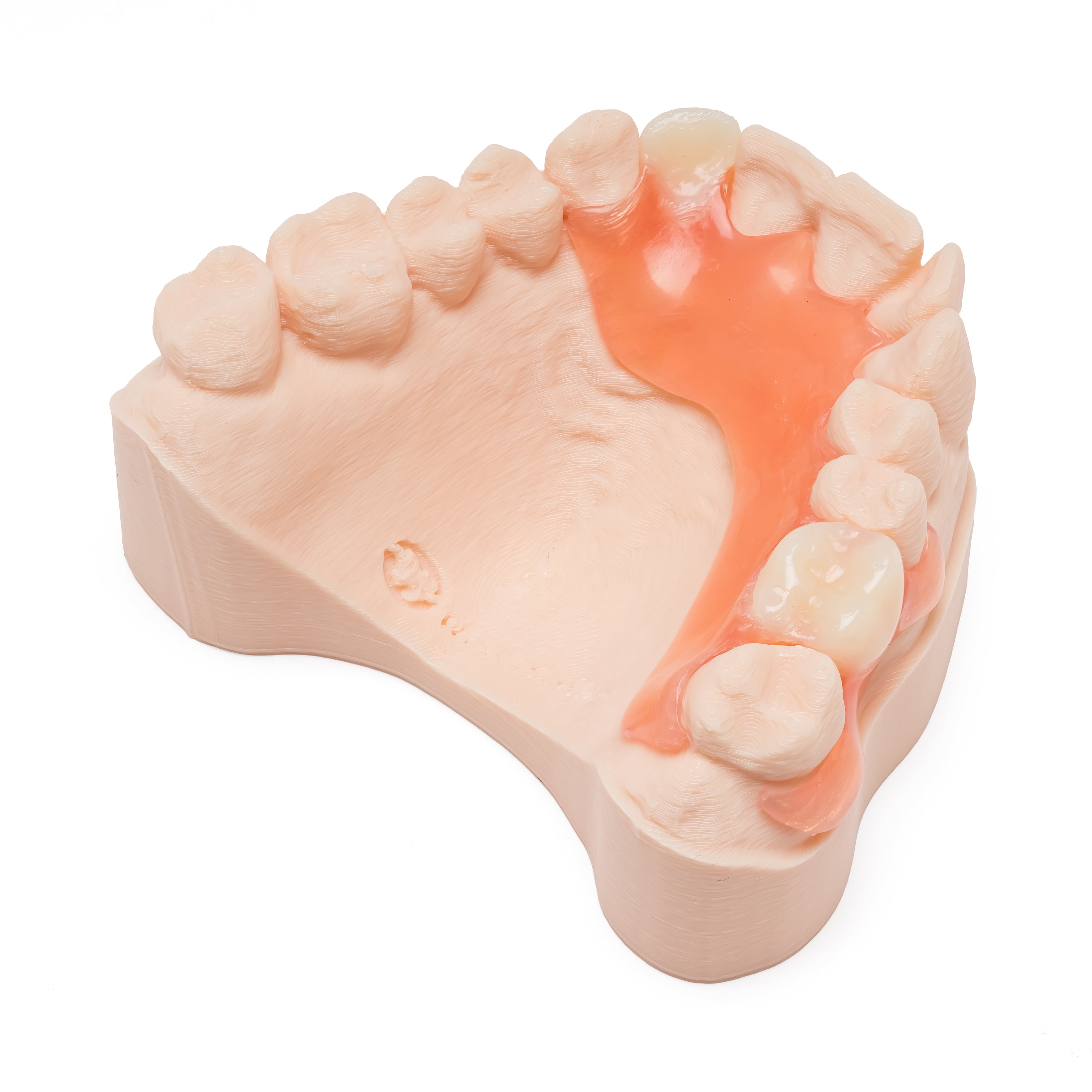 Pink and white partial denture with multiple teeth on a dental model on a white background