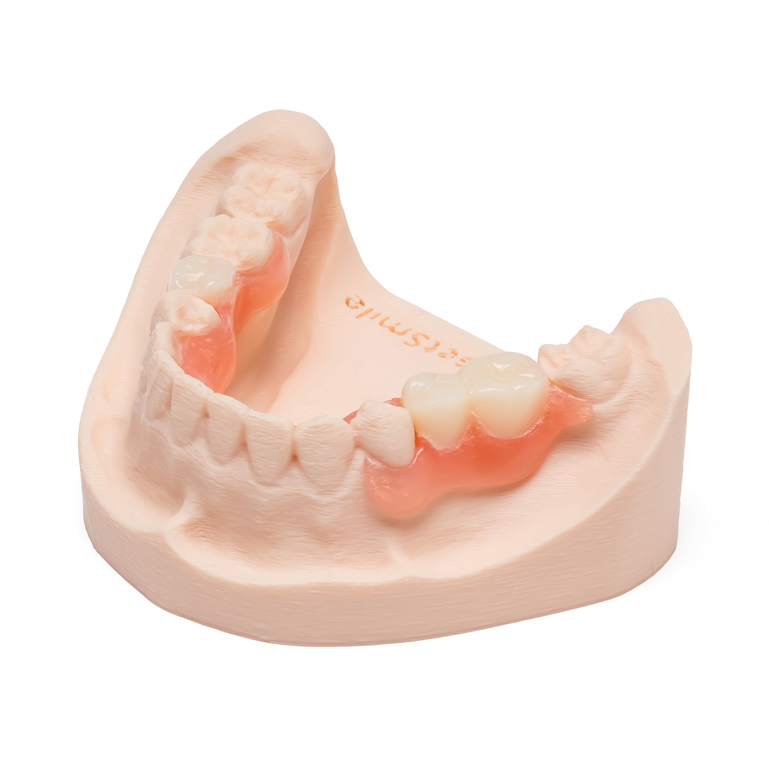 Pink and white partial denture with multiple teeth on a dental model on a white background