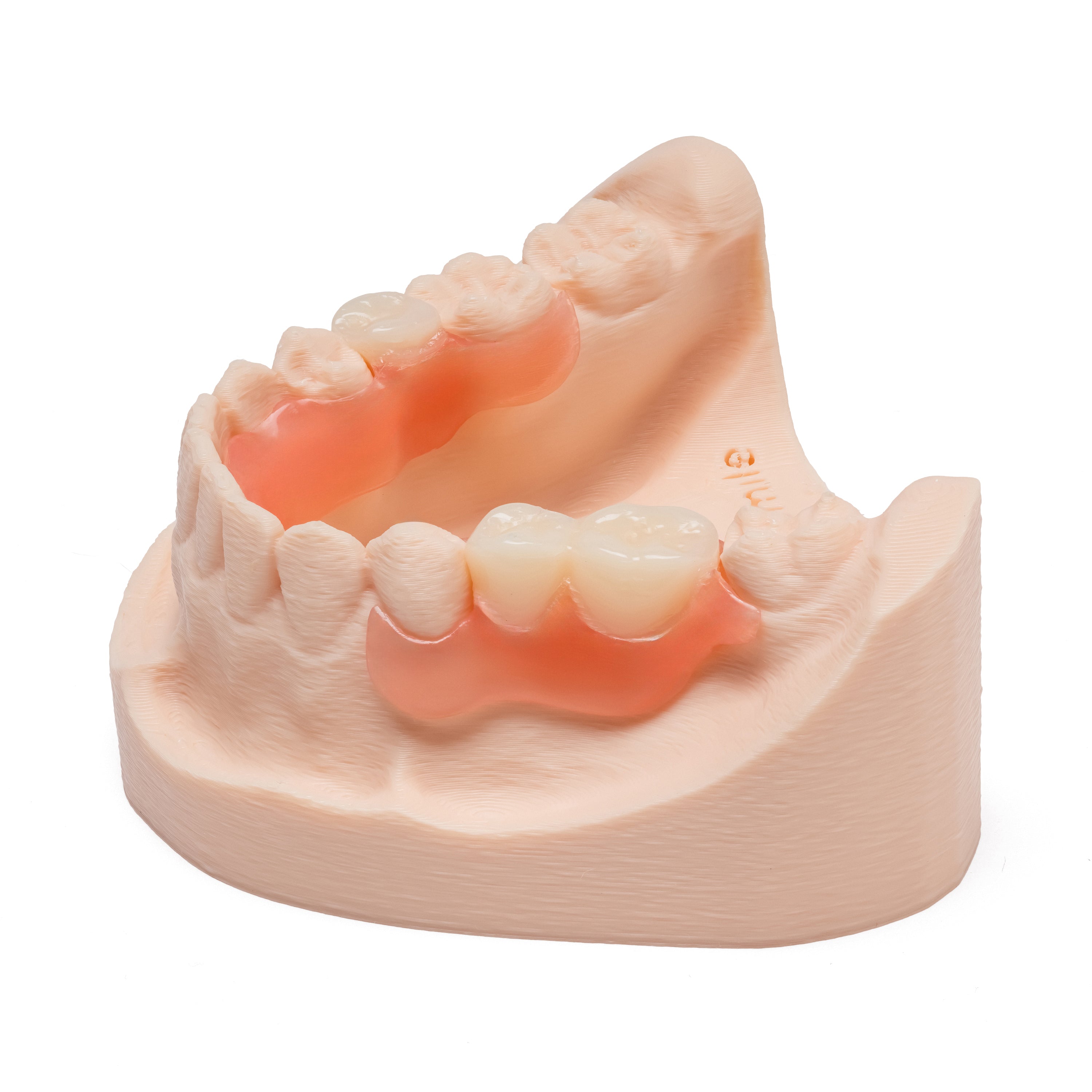 Pink and white partial denture with multiple teeth on a dental model on a white background