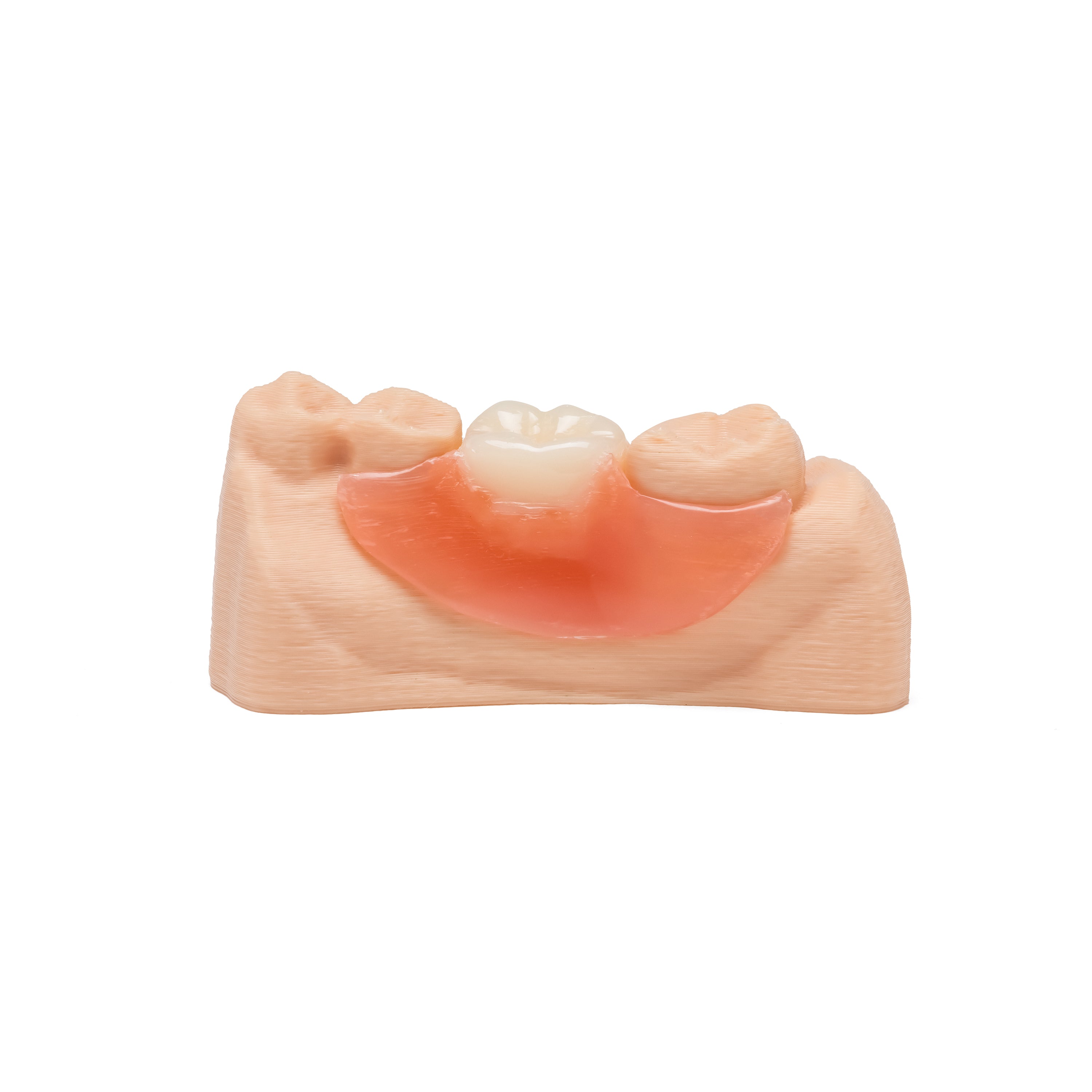 Single posterior back tooth flexible partial denture placed on a dental model on white background.