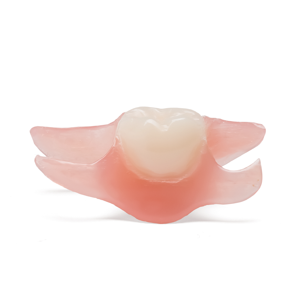 Photo of One Tooth Lower Partial Denture