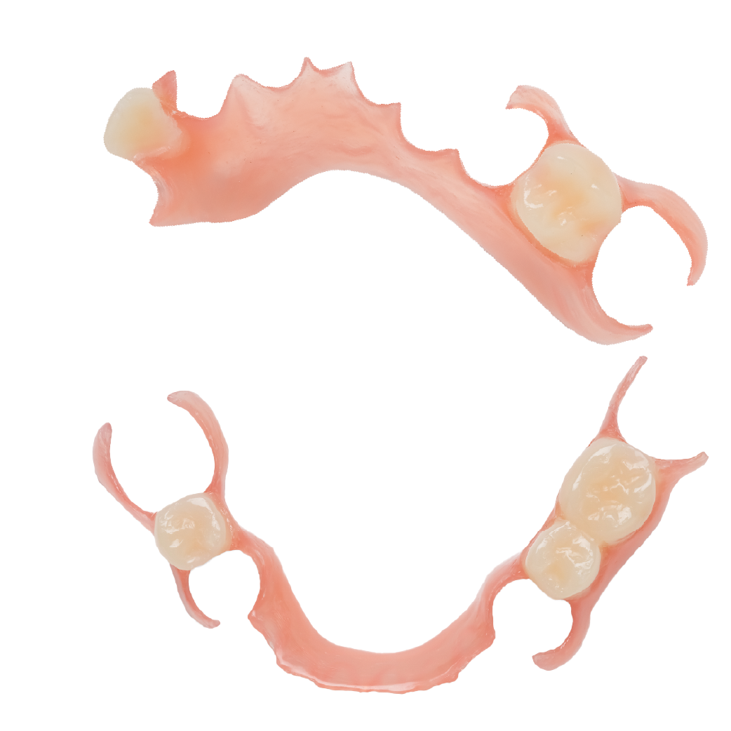 Photo of Two Arch Upper & Lower Partial Dentures
